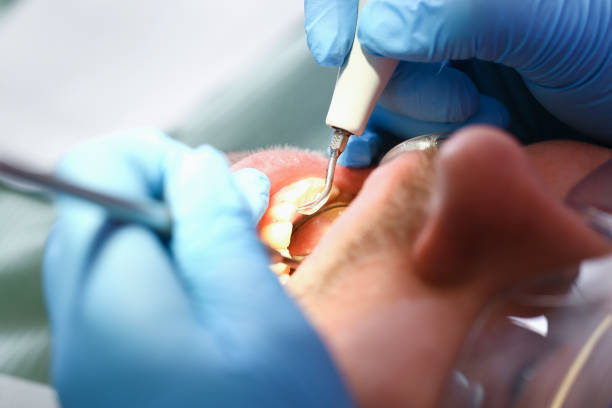 Best Emergency Broken Tooth Repair in Clifton, IL