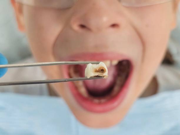 Best Urgent Dental Care in Clifton, IL